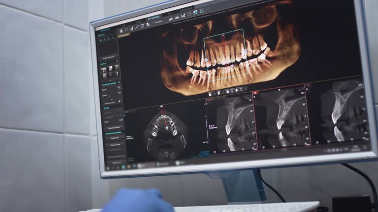 Full Mouth Reconstruction in Okmulgee, OK